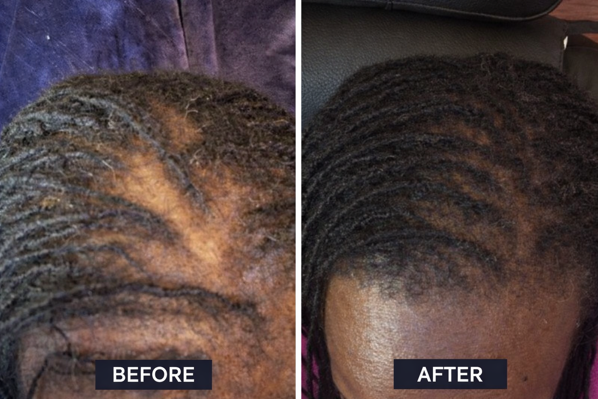 Consecré Batana oil customer hair comparison results